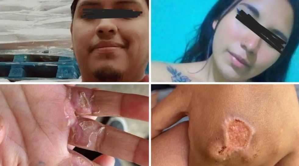 Madre y padrastro son detenidos por torturar a dos niñas de 4 y 6 años en Edomex