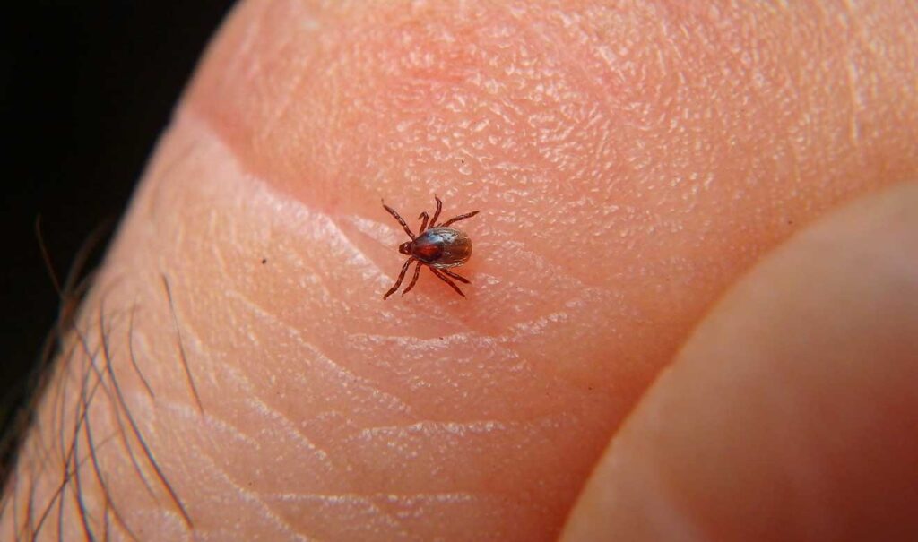 Gestiona Comusal atención médica especializada para niña con posible caso de rickettsia