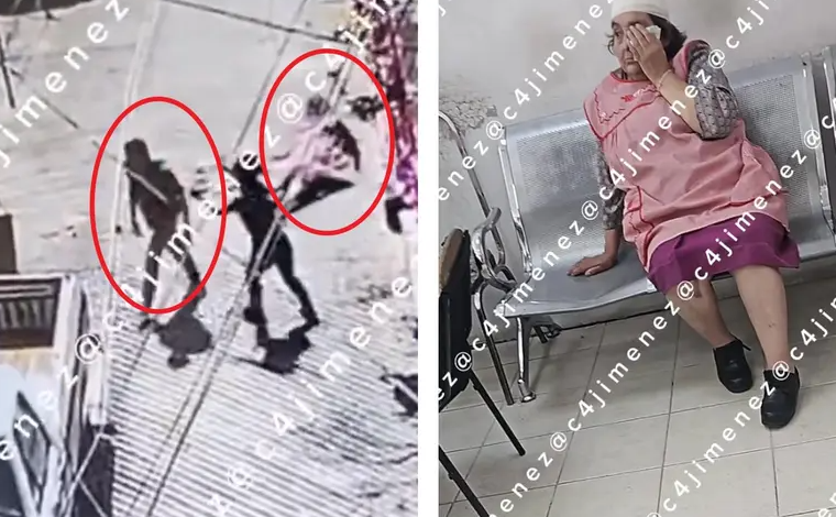 ¡Infeliz! Le ‘suelta cabezazo’ a abuelita y roba su dinero