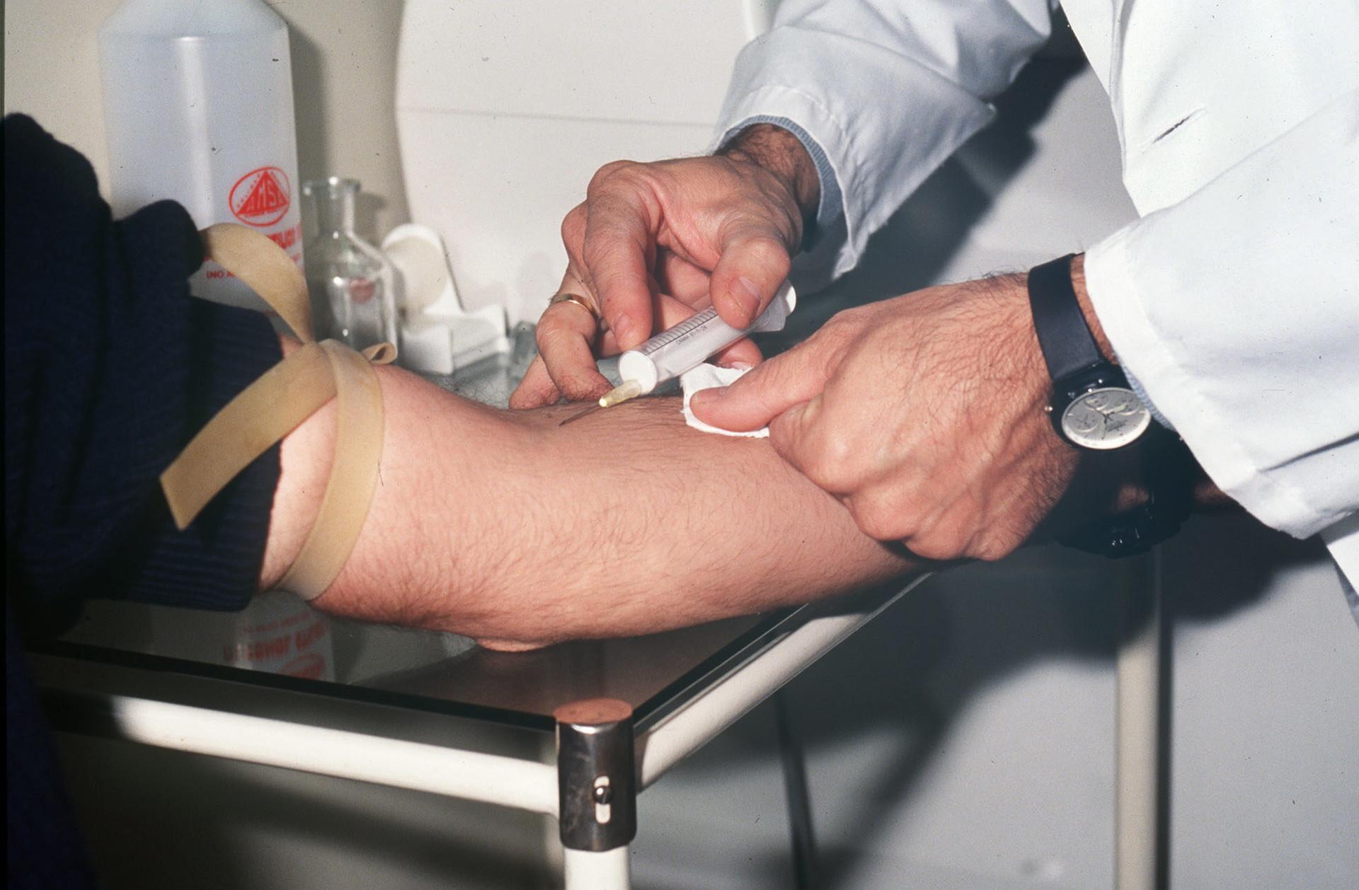 Análisis genético podría detectar el párkinson antes de los primeros síntomas