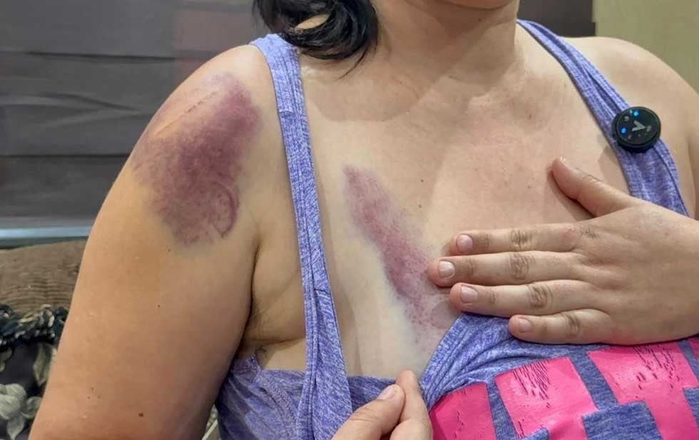 Madre agredida en la Técnica 52 tiene esta semana para apelar