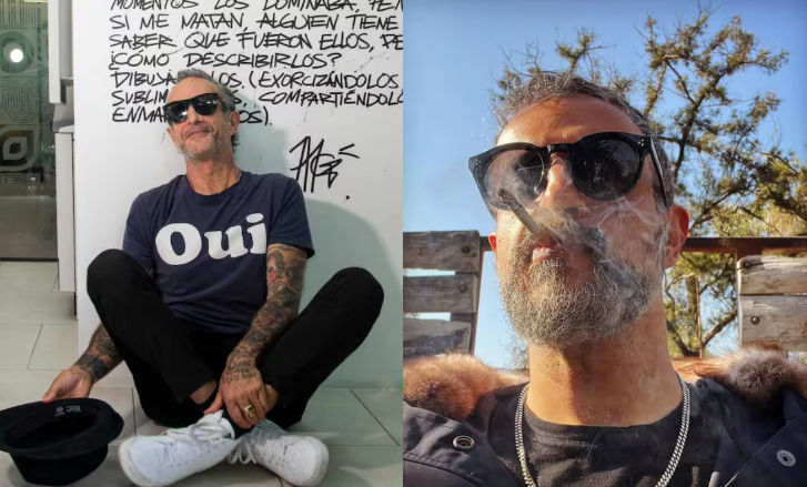 Tito Fuentes de Molotov muestra cómo quedó su rostro tras 11 cirugías y estar en coma por adicciones