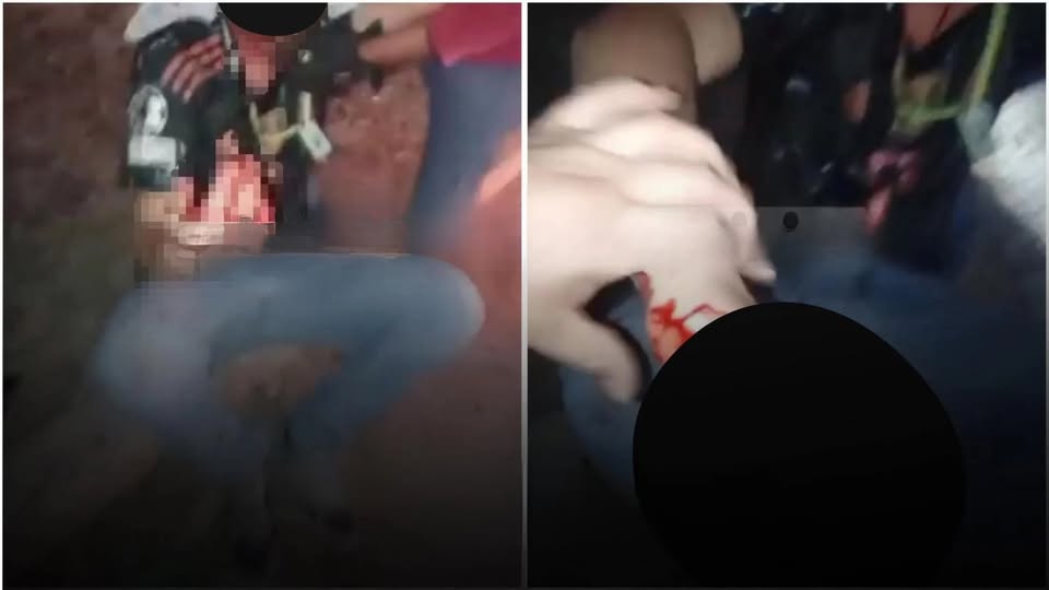 Joven gravemente herido tras ser atacado con machete por siete enmascarados en Delicias