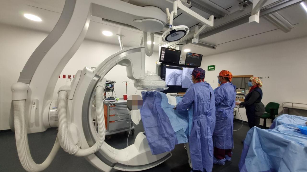 Salva IMSS Chihuahua vida de paciente, con primera trombectomía pulmonar endovascular en el estado