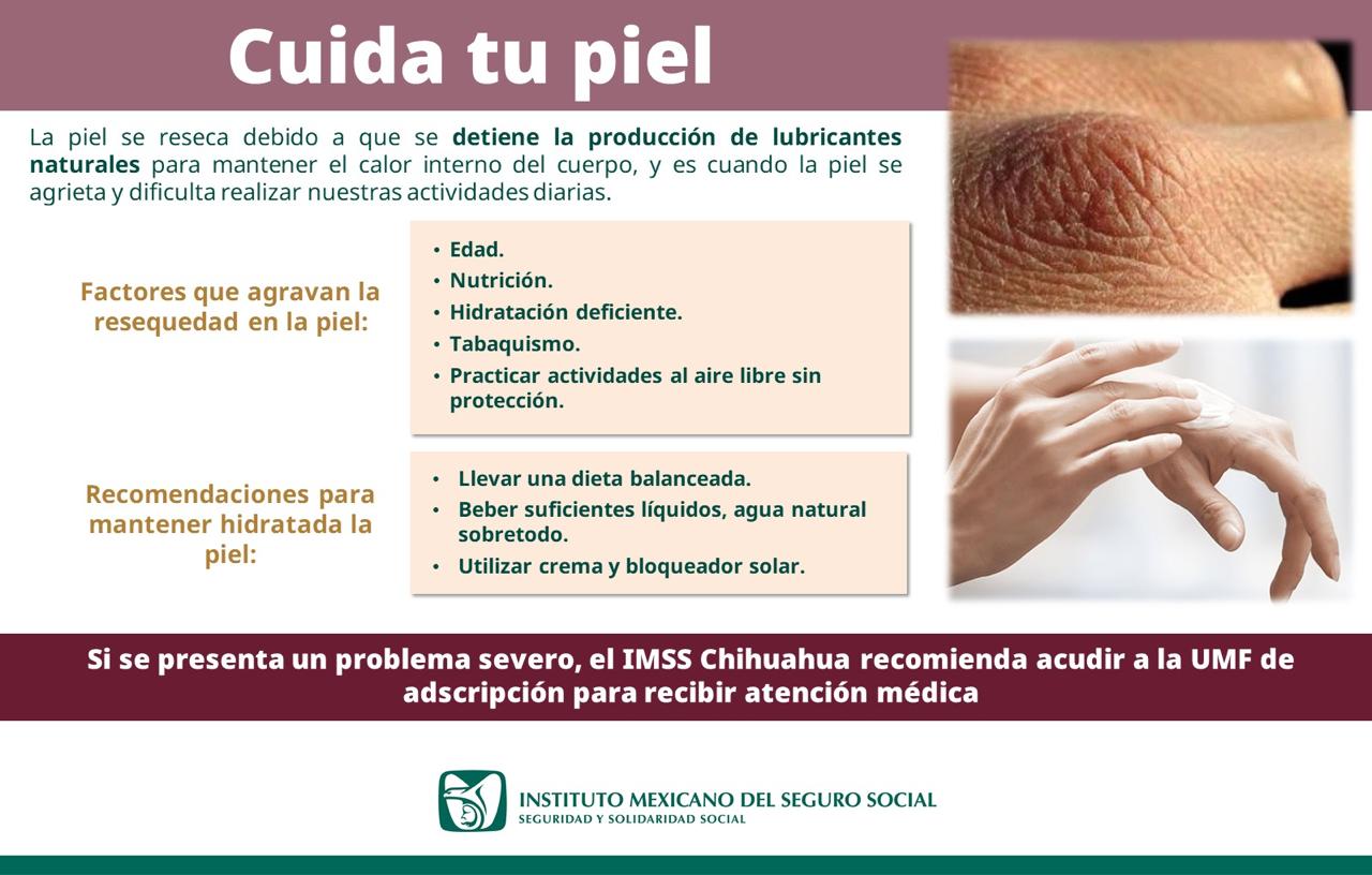 Recomienda IMSS Chihuahua mantener humectada la piel en esta temporada invernal