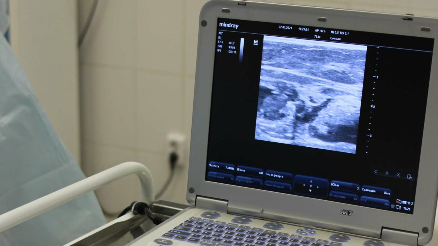 Bebé en gestación es operado de un tumor en el pulmón en hospital de Lima