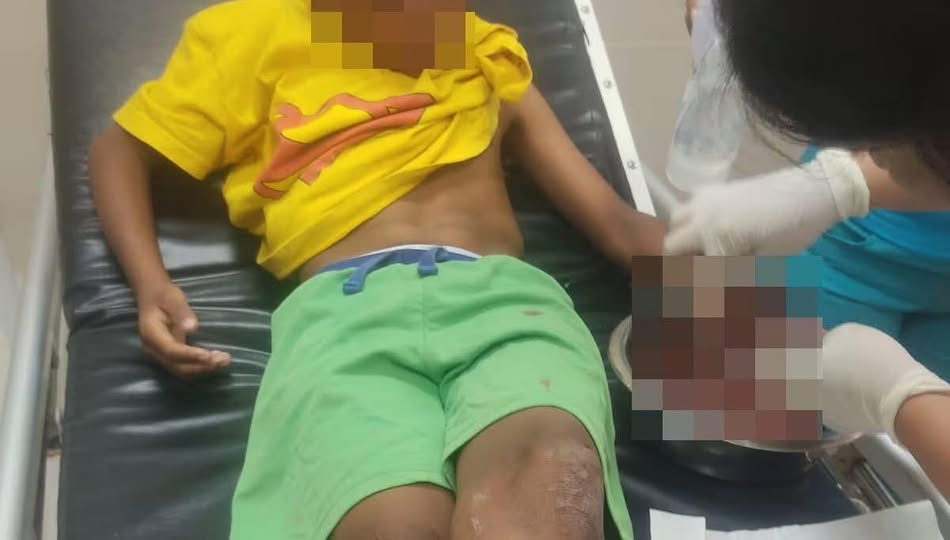 Amputó “paloma” dedos de joven en Cuatro Vientos, Delicias