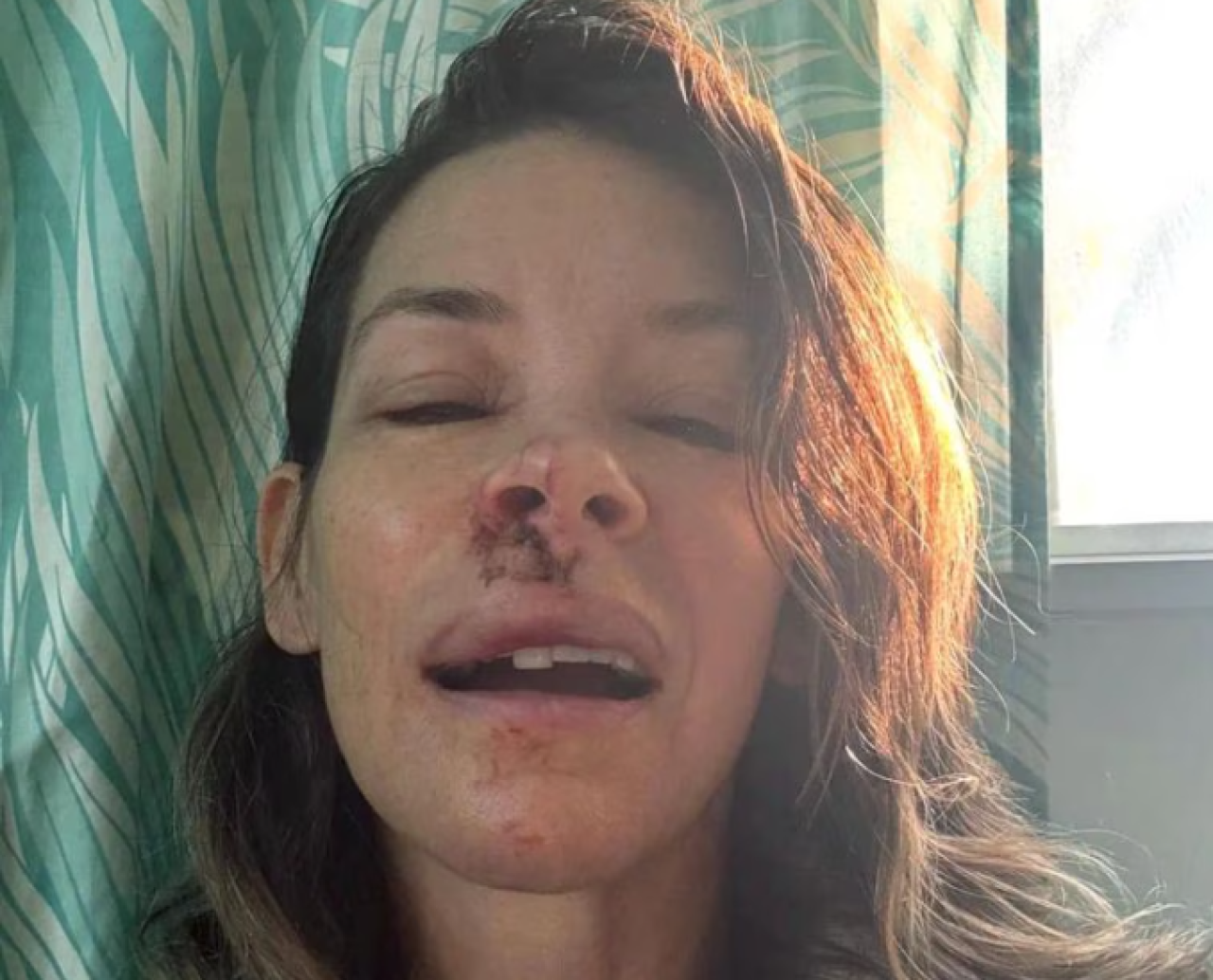 Publica Evangeline Lilly estrella de Lost y Ant-Man padecer de daño cerebral