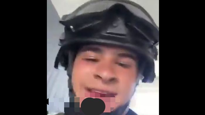 ???? ¡DE MILAGRO! ???? Soldado sobrevive con una ojiva incrustada en el rostro tras feroz combate. ????