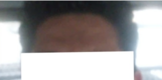 ¡DE TERROR! Abuelito pierde un ojo tras brutal golpiza de un médico por una cochera.