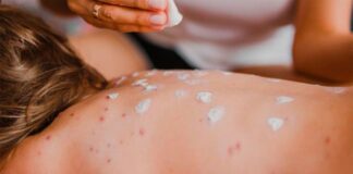 ALERTA NACIONAL: Chihuahua encabeza lista de muertes por brote de sarampión